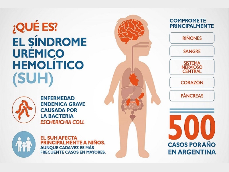 sindrome-uremico-hemolitico